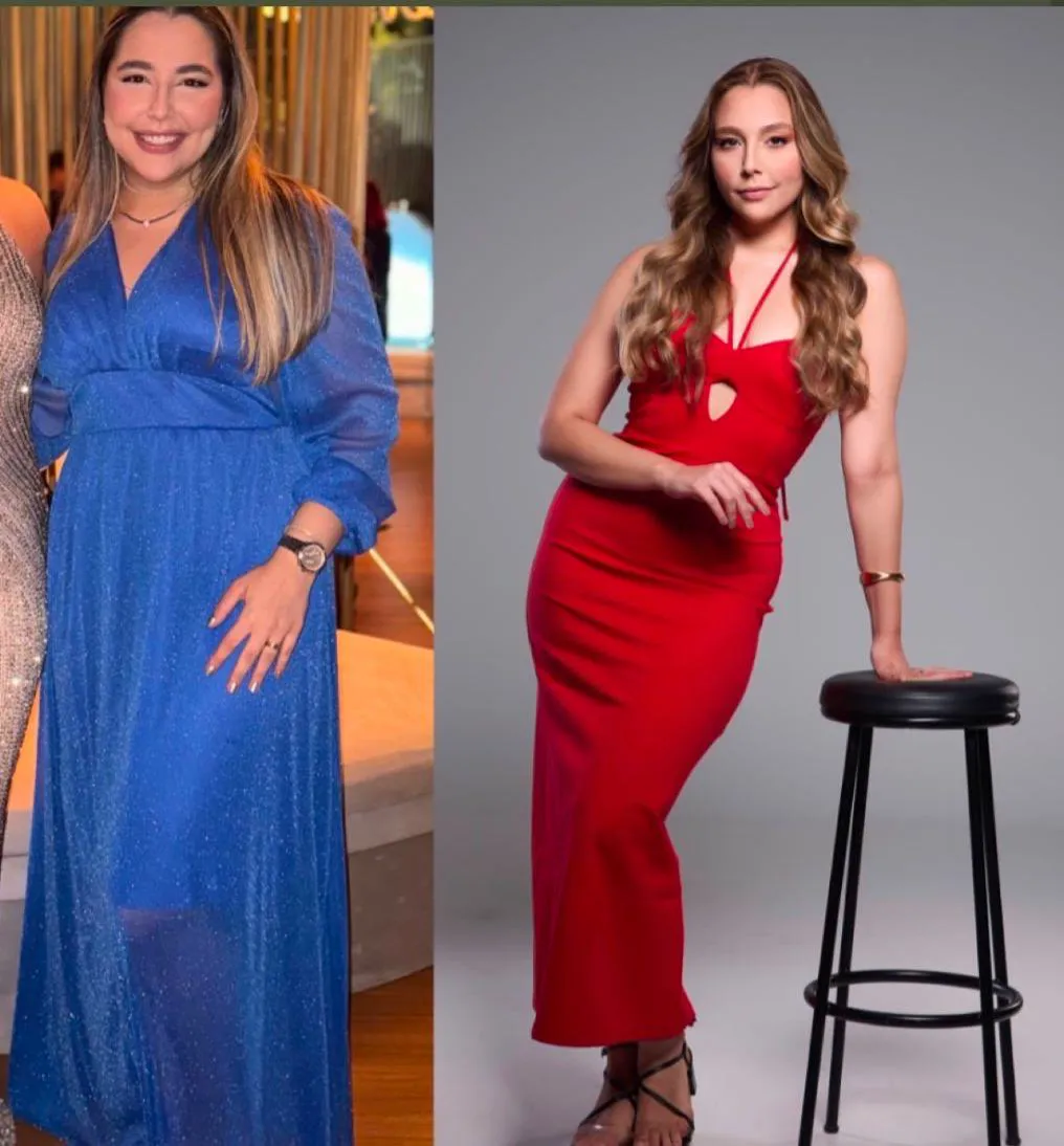 Antes e depois de paciente em programa de emagrecimento em São José do Rio Preto