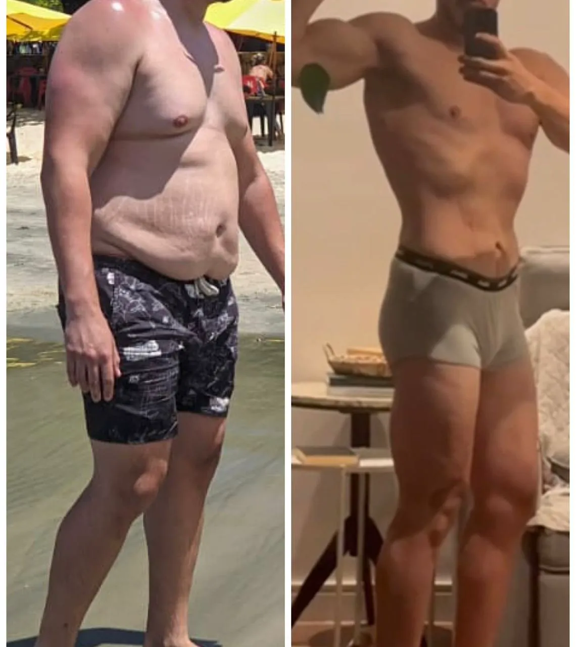 Antes e depois de recomposição corporal masculina na Santé Clinic