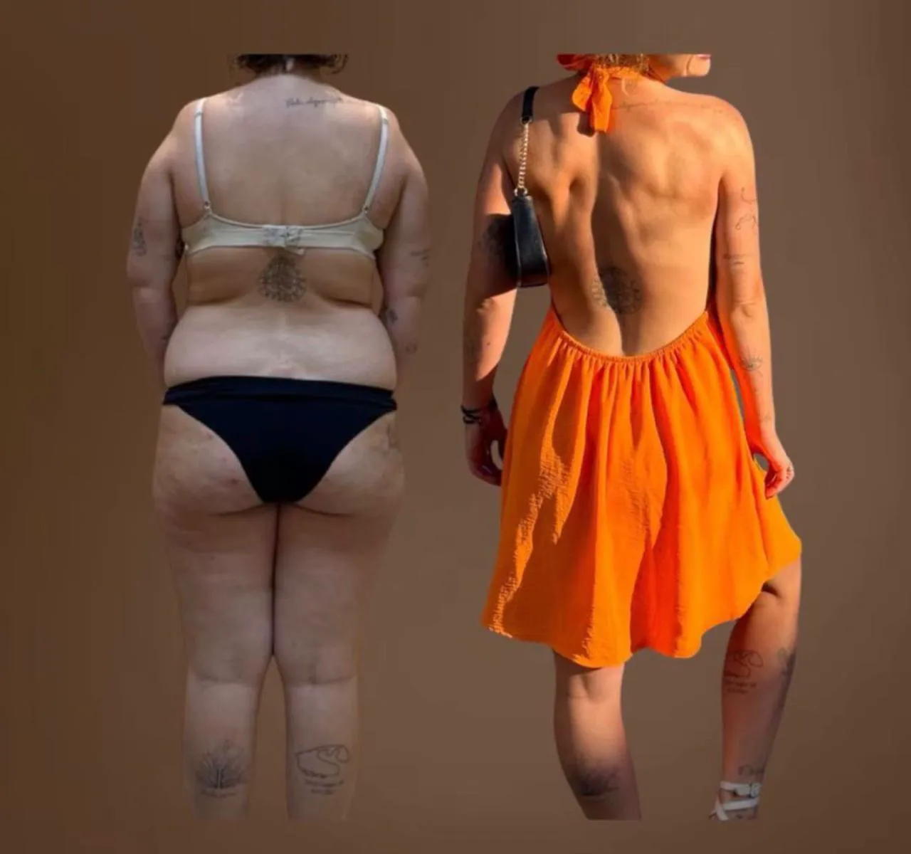 Antes e depois de emagrecimento feminino com acompanhamento médico contínuo