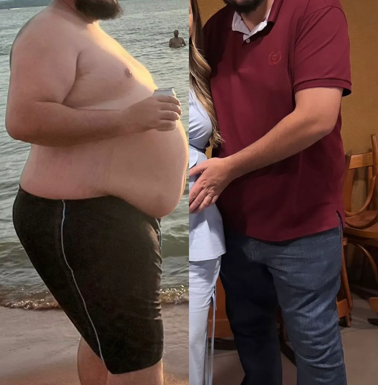 Antes e depois de emagrecimento masculino acompanhado por nutrólogo em São José do Rio Preto