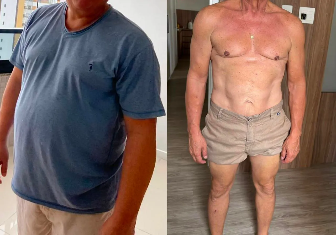 Antes e depois de emagrecimento masculino, evolução acompanhada por médicos
